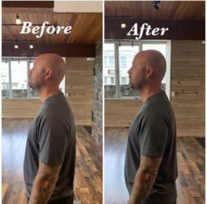 Forward Head Posture: A Non-traditional Approach - The Movement Paradigm