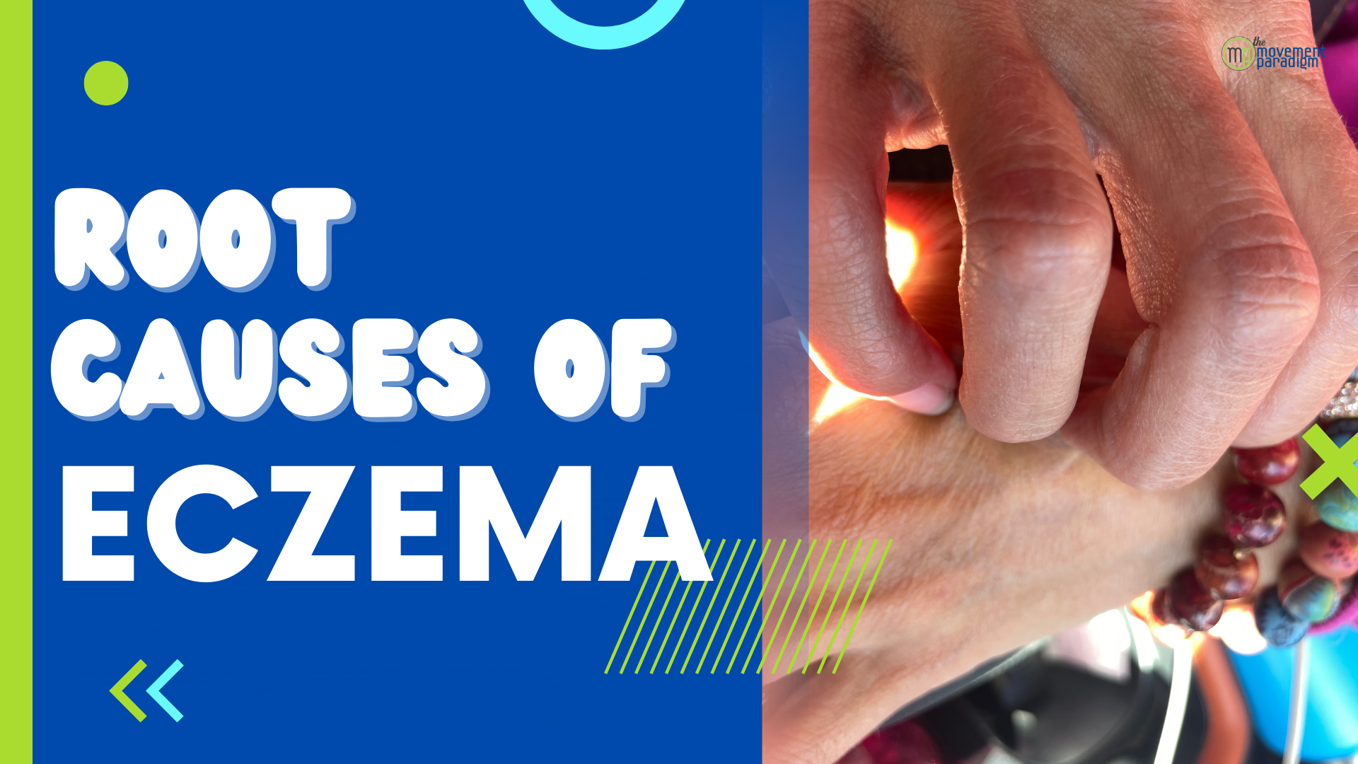 Root causes of eczema